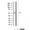 Western blot analysis of extracts from various samples, using AEBP2 antibody.
 Lane 1: Mouse myeloma treated with blocking peptide.
 Lane 2: Mouse myeloma;
 Lane 3: B16F10;
 