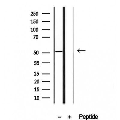 Western blot analysis of extracts from various samples, using AEBP2 antibody.
 Lane 1: Mouse myeloma treated with blocking peptide.
 Lane 2: Mouse myeloma;
 Lane 3: B16F10;
 