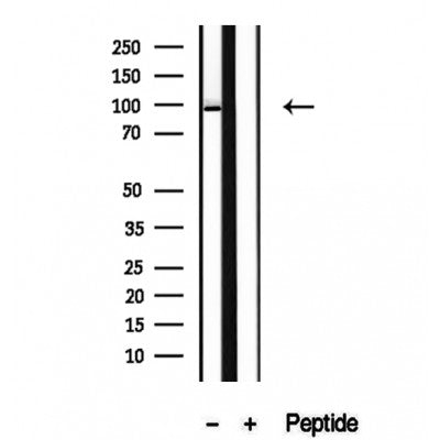 DF12246 at 1/100 staining Rat liver tissue by IHC-P. The sample was formaldehyde fixed and a heat mediated antigen retrieval step in citrate buffer was performed. The sample was then blocked and incubated with the antibody for 1.5 hours at 22¡ãC. An HRP conjugated goat anti-rabbit antibody was used as the secondary