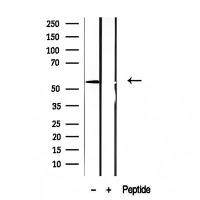 Western blot analysis of extracts from VERO, using ASAH1 Antibody. The lane on the left was treated with blocking peptide.