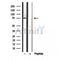 Western blot analysis of extracts from Rat lung, using BBS7 Antibody. The lane on the left was treated with blocking peptide.