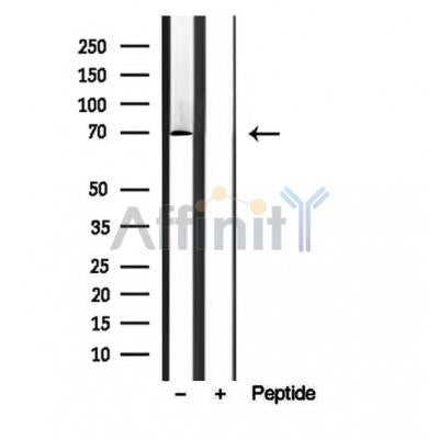 Western blot analysis of extracts from Rat lung, using BBS7 Antibody. The lane on the left was treated with blocking peptide.
