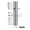 DF12251 at 1/100 staining Human lymph cancer tissue by IHC-P. The sample was formaldehyde fixed and a heat mediated antigen retrieval step in citrate buffer was performed. The sample was then blocked and incubated with the antibody for 1.5 hours at 22¡ãC. An HRP conjugated goat anti-rabbit antibody was used as the secondary