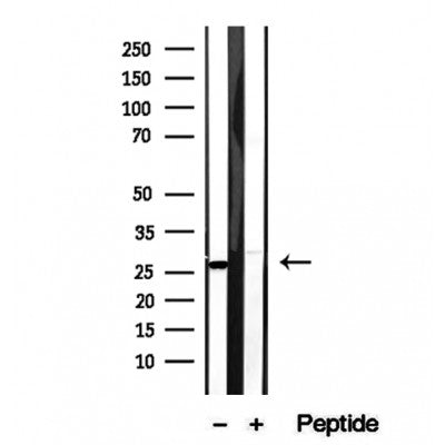 DF12254 at 1/100 staining Mouse lung tissue by IHC-P. The sample was formaldehyde fixed and a heat mediated antigen retrieval step in citrate buffer was performed. The sample was then blocked and incubated with the antibody for 1.5 hours at 22¡ãC. An HRP conjugated goat anti-rabbit antibody was used as the secondary