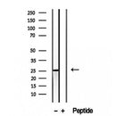 Western blot analysis of extracts from rat brain, using CHCHD6 antibody. Lane 1 was treated with the blocking peptide.