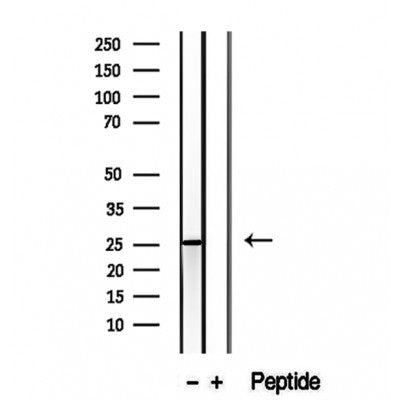 Western blot analysis of extracts from rat brain, using CHCHD6 antibody. Lane 1 was treated with the blocking peptide.