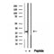 DF12256 staining HepG2 by IF/ICC. The sample were fixed with PFA and permeabilized in 0.1% Triton X-100,then blocked in 10% serum for 45 minutes at 25¡ãC. The primary antibody was diluted at 1/200 and incubated with the sample for 1 hour at 37¡ãC. An  Alexa Fluor 594 conjugated goat anti-rabbit IgG (H+L) Ab, diluted at 1/600, was used as the secondary antibod