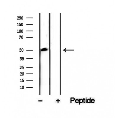 DF12257 staining Hela by IF/ICC. The samples were fixed with PFA and permeabilized in 0.1% Triton X-100,then blocked in 10% serum for 45 minutes at 25¡ãC. Samples were then incubated with primary Ab(DF12257 1:200) and mouse anti-beta tubulin Ab(T0023 1:200) for 1 hour at 37¡ãC. An  AlexaFluor594 conjugated goat anti-rabbit IgG(H+L) Ab(S0006 1:200 Red) and an AlexaFluor488 conjugated goat anti-mouse IgG(H+L) Ab(S0017 1:600 Green) were used as the secondary antibod