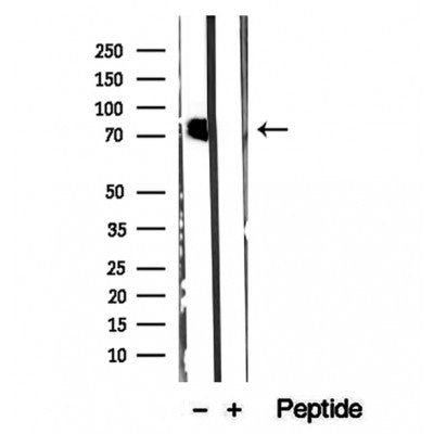 DF12258 staining Hela by IF/ICC. The samples were fixed with PFA and permeabilized in 0.1% Triton X-100,then blocked in 10% serum for 45 minutes at 25¡ãC. Samples were then incubated with primary Ab(DF12258 1:200) and mouse anti-beta tubulin Ab(T0023 1:200) for 1 hour at 37¡ãC. An  AlexaFluor594 conjugated goat anti-rabbit IgG(H+L) Ab(S0006 1:200 Red) and an AlexaFluor488 conjugated goat anti-mouse IgG(H+L) Ab(S0017 1:600 Green) were used as the secondary antibod