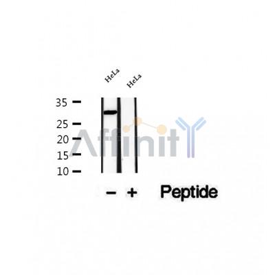 DF12260 at 1/100 staining Human gastric tissue by IHC-P. The sample was formaldehyde fixed and a heat mediated antigen retrieval step in citrate buffer was performed. The sample was then blocked and incubated with the antibody for 1.5 hours at 22¡ãC. An HRP conjugated goat anti-rabbit antibody was used as the secondary