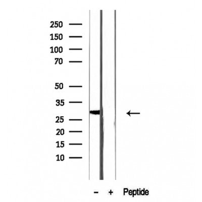 Western blot analysis of extracts of human testis tissue, using CRISP2 antibody.
