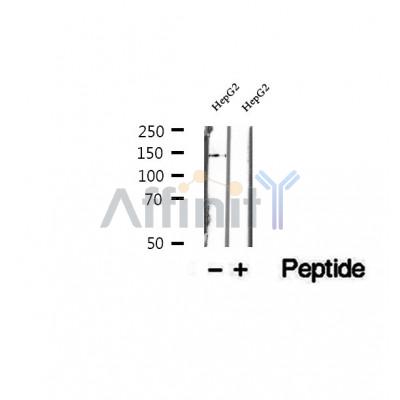 DF12265 at 1/100 staining Human liver tissue by IHC-P. The sample was formaldehyde fixed and a heat mediated antigen retrieval step in citrate buffer was performed. The sample was then blocked and incubated with the antibody for 1.5 hours at 22¡ãC. An HRP conjugated goat anti-rabbit antibody was used as the secondary