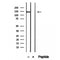 Western blot analysis of extracts from Mouse myeloma, using DHX9 antibody. Lane 1 was treated with the blocking peptide.