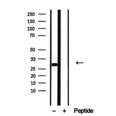 Western blot analysis of extracts from various samples, using DNAJB3 Antibody.
 Lane 1: Sp2/0 treated with blocking peptide.
 Lane 2: Sp2/0;
 Lane 3: Mouse spleen;
 