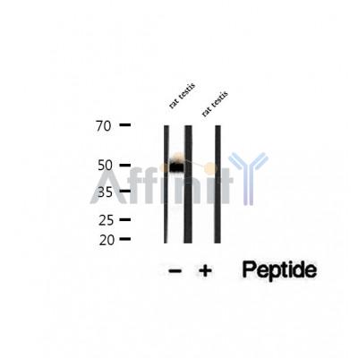 DF12270 staining HepG2 by IF/ICC. The sample were fixed with PFA and permeabilized in 0.1% Triton X-100,then blocked in 10% serum for 45 minutes at 25¡ãC. The primary antibody was diluted at 1/200 and incubated with the sample for 1 hour at 37¡ãC. An  Alexa Fluor 594 conjugated goat anti-rabbit IgG (H+L) Ab, diluted at 1/600, was used as the secondary antibod