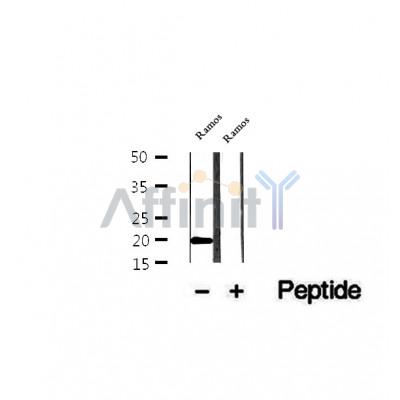 DF12272 staining HepG2 by IF/ICC. The sample were fixed with PFA and permeabilized in 0.1% Triton X-100,then blocked in 10% serum for 45 minutes at 25¡ãC. The primary antibody was diluted at 1/200 and incubated with the sample for 1 hour at 37¡ãC. An  Alexa Fluor 594 conjugated goat anti-rabbit IgG (H+L) Ab, diluted at 1/600, was used as the secondary antibod
