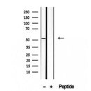 Western blot analysis of extracts from HepG2, using HERP Antibody. Lane 1 was treated with the blocking peptide.