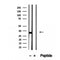 Western blot analysis of extracts from HepG2, using Histone H1.2 Antibody. Lane 1 was treated with the blocking peptide.