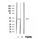 DF12280 staining HepG2 by IF/ICC. The sample were fixed with PFA and permeabilized in 0.1% Triton X-100,then blocked in 10% serum for 45 minutes at 25¡ãC. The primary antibody was diluted at 1/200 and incubated with the sample for 1 hour at 37¡ãC. An  Alexa Fluor 594 conjugated goat anti-rabbit IgG (H+L) Ab, diluted at 1/600, was used as the secondary antibod