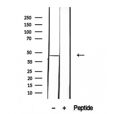 DF12280 staining HepG2 by IF/ICC. The sample were fixed with PFA and permeabilized in 0.1% Triton X-100,then blocked in 10% serum for 45 minutes at 25¡ãC. The primary antibody was diluted at 1/200 and incubated with the sample for 1 hour at 37¡ãC. An  Alexa Fluor 594 conjugated goat anti-rabbit IgG (H+L) Ab, diluted at 1/600, was used as the secondary antibod