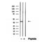 Western blot analysis of extracts from various samples, using IVD Antibody.
 Lane 1: Rat brain treated with blocking peptide.
 Lane 2: Rat brain;
 Lane 3: 3T3-L1;
 Lane 4: HepG2;
 Lane 5: Mouse lung;
 