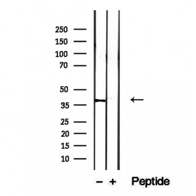 Western blot analysis of extracts from various samples, using IVD Antibody.
 Lane 1: Rat brain treated with blocking peptide.
 Lane 2: Rat brain;
 Lane 3: 3T3-L1;
 Lane 4: HepG2;
 Lane 5: Mouse lung;
 