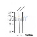 DF12287 staining HepG2 by IF/ICC. The sample were fixed with PFA and permeabilized in 0.1% Triton X-100,then blocked in 10% serum for 45 minutes at 25¡ãC. The primary antibody was diluted at 1/200 and incubated with the sample for 1 hour at 37¡ãC. An  Alexa Fluor 594 conjugated goat anti-rabbit IgG (H+L) Ab, diluted at 1/600, was used as the secondary antibod