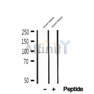DF12287 staining HepG2 by IF/ICC. The sample were fixed with PFA and permeabilized in 0.1% Triton X-100,then blocked in 10% serum for 45 minutes at 25¡ãC. The primary antibody was diluted at 1/200 and incubated with the sample for 1 hour at 37¡ãC. An  Alexa Fluor 594 conjugated goat anti-rabbit IgG (H+L) Ab, diluted at 1/600, was used as the secondary antibod