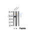 DF12288 at 1/100 staining Human breast cancer tissue by IHC-P. The sample was formaldehyde fixed and a heat mediated antigen retrieval step in citrate buffer was performed. The sample was then blocked and incubated with the antibody for 1.5 hours at 22¡ãC. An HRP conjugated goat anti-rabbit antibody was used as the secondary