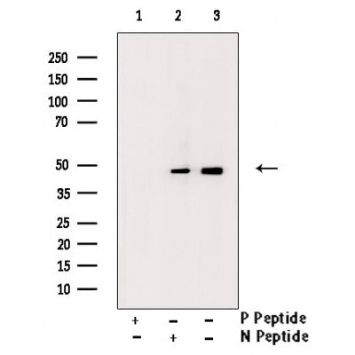 AF3496 staining 293 by IF/ICC. The sample were fixed with PFA and permeabilized in 0.1% Triton X-100,then blocked in 10% serum for 45 minutes at 25¡ãC. The primary antibody was diluted at 1/200 and incubated with the sample for 1 hour at 37¡ãC. An  Alexa Fluor 594 conjugated goat anti-rabbit IgG (H+L) Ab, diluted at 1/600, was used as the secondary antibod