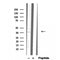 DF12291 staining Hela by IF/ICC. The sample were fixed with PFA and permeabilized in 0.1% Triton X-100,then blocked in 10% serum for 45 minutes at 25¡ãC. The primary antibody was diluted at 1/200 and incubated with the sample for 1 hour at 37¡ãC. An  Alexa Fluor 594 conjugated goat anti-rabbit IgG (H+L) Ab, diluted at 1/600, was used as the secondary antibod