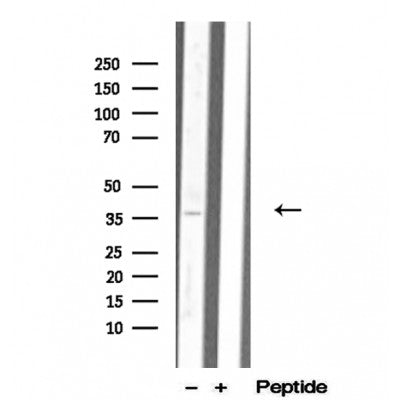 DF12291 staining Hela by IF/ICC. The sample were fixed with PFA and permeabilized in 0.1% Triton X-100,then blocked in 10% serum for 45 minutes at 25¡ãC. The primary antibody was diluted at 1/200 and incubated with the sample for 1 hour at 37¡ãC. An  Alexa Fluor 594 conjugated goat anti-rabbit IgG (H+L) Ab, diluted at 1/600, was used as the secondary antibod