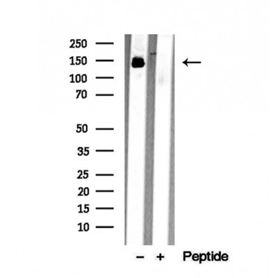 Western blot analysis of extracts from various samples, using mDia1 Antibody.
 Lane 1: 3T3-L1 treated with blocking peptide.
 Lane 2: 3T3-L1;
 Lane 3: HepG2;
 
