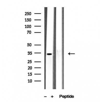 DF12295 staining Hela by IF/ICC. The sample were fixed with PFA and permeabilized in 0.1% Triton X-100,then blocked in 10% serum for 45 minutes at 25¡ãC. The primary antibody was diluted at 1/200 and incubated with the sample for 1 hour at 37¡ãC. An  Alexa Fluor 594 conjugated goat anti-rabbit IgG (H+L) Ab, diluted at 1/600, was used as the secondary antibod