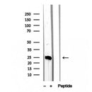 Western blot analysis of extracts from various samples, using MPZL2 Antibody.
 Lane 1: RAW264.7, treated with blocking peptide;
 Lane 2: RAW264.7;
 Lane 3: Pc12.