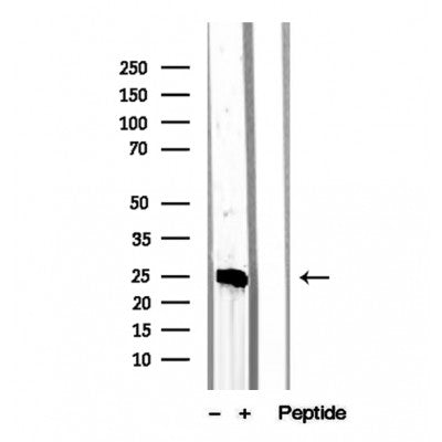 Western blot analysis of extracts from various samples, using MPZL2 Antibody.
 Lane 1: RAW264.7, treated with blocking peptide;
 Lane 2: RAW264.7;
 Lane 3: Pc12.