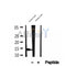 DF12299 at 1/100 staining Human breast cancer tissue by IHC-P. The sample was formaldehyde fixed and a heat mediated antigen retrieval step in citrate buffer was performed. The sample was then blocked and incubated with the antibody for 1.5 hours at 22¡ãC. An HRP conjugated goat anti-rabbit antibody was used as the secondary