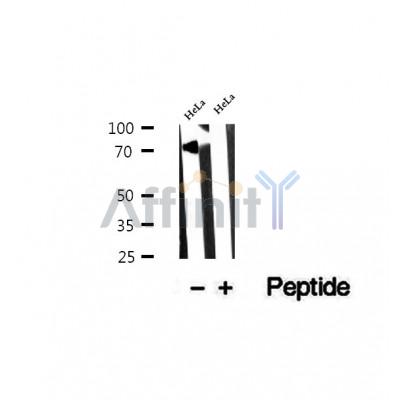 DF12302 at 1/100 staining Human lung tissue by IHC-P. The sample was formaldehyde fixed and a heat mediated antigen retrieval step in citrate buffer was performed. The sample was then blocked and incubated with the antibody for 1.5 hours at 22¡ãC. An HRP conjugated goat anti-rabbit antibody was used as the secondary
