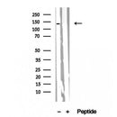 Western blot analysis of extracts from 293, using PER2 Antibody. The lane on the left was treated with blocking peptide.