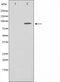 AF5004 staining HeLa by IF/ICC. The sample were fixed with PFA and permeabilized in 0.1% Triton X-100,then blocked in 10% serum for 45 minutes at 25¡ãC. The primary antibody was diluted at 1/200 and incubated with the sample for 1 hour at 37¡ãC. An  Alexa Fluor 594 conjugated goat anti-rabbit IgG (H+L) Ab, diluted at 1/600, was used as the secondary antibod