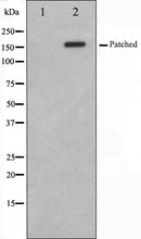 Western blot analysis on mouse muscle cell lysate using Patched Antibody. The lane on the left is treated with the antigen-specific peptide.