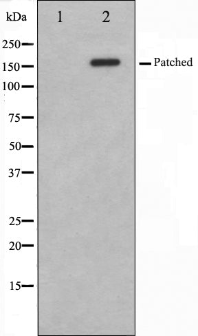Western blot analysis on mouse muscle cell lysate using Patched Antibody. The lane on the left is treated with the antigen-specific peptide.