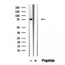 Western blot analysis of extracts from PC12, using RASGRP3 Antibody. The lane on the left was treated with blocking peptide.

Observed bands: 90 kDa.
