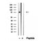 Western blot analysis of extracts from PC12, using RASGRP3 Antibody. The lane on the left was treated with blocking peptide.

Observed bands: 90 kDa.