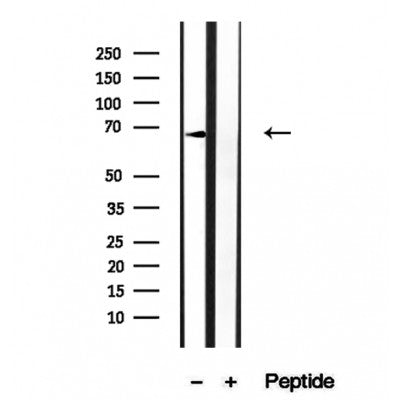 Western blot analysis of extracts from various samples, using RNF156 antibody.
 Lane 1: mouse brain treated with blocking peptide.
 Lane 2: Mouse brain;
 Lane 3: 3T3;
 Lane 4: Hela;
 