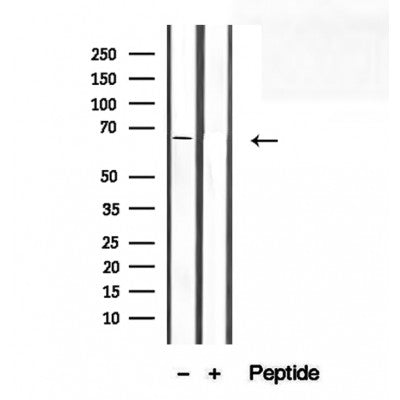 DF12315 staining Hela by IF/ICC. The samples were fixed with PFA and permeabilized in 0.1% Triton X-100,then blocked in 10% serum for 45 minutes at 25¡ãC. Samples were then incubated with primary Ab(DF12315 1:200) and mouse anti-beta tubulin Ab(T0023 1:200) for 1 hour at 37¡ãC. An  AlexaFluor594 conjugated goat anti-rabbit IgG(H+L) Ab(S0006 1:200 Red) and an AlexaFluor488 conjugated goat anti-mouse IgG(H+L) Ab(S0017 1:600 Green) were used as the secondary antibod