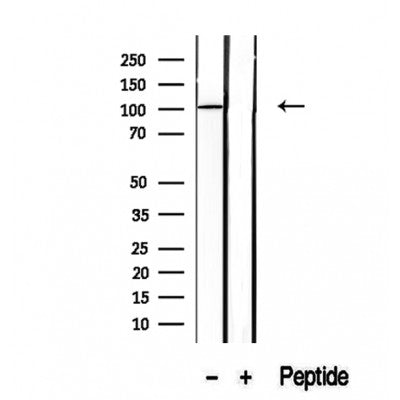 Western blot analysis of extracts from various samples, using SFPQ antibody.
 Lane 1: mouse brain treated with blocking peptide.
 Lane 2: Mouse brain;
 Lane 3: 3T3;
 Lane 4: Hela;
 