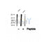 DF12318 at 1/100 staining Human lymph cancer tissue by IHC-P. The sample was formaldehyde fixed and a heat mediated antigen retrieval step in citrate buffer was performed. The sample was then blocked and incubated with the antibody for 1.5 hours at 22¡ãC. An HRP conjugated goat anti-rabbit antibody was used as the secondary