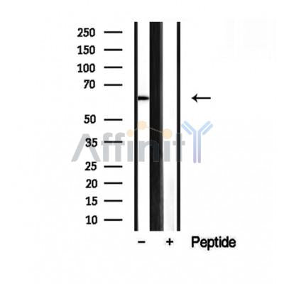 Western blot analysis of extracts from various samples, using SMOX antibody.
 Lane 1: rat brain treated with blocking peptide.
 Lane 2: Rat brain;
 Lane 3: 293;
 