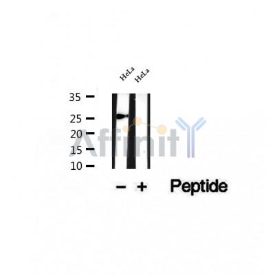DF12321 at 1/100 staining Rat brain tissue by IHC-P. The sample was formaldehyde fixed and a heat mediated antigen retrieval step in citrate buffer was performed. The sample was then blocked and incubated with the antibody for 1.5 hours at 22¡ãC. An HRP conjugated goat anti-rabbit antibody was used as the secondary